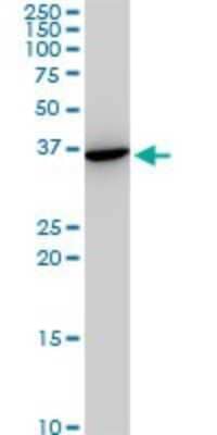 Western Blot: Slug Antibody (3C12) [H00006591-M05]