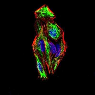 Immunocytochemistry/ Immunofluorescence: Slug Antibody (4B6D5) - BSA Free [NBP2-52570]