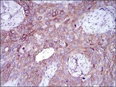 Immunohistochemistry-Paraffin: Slug Antibody (4B6D5) - BSA Free [NBP2-52570]