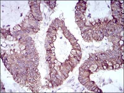 Immunohistochemistry-Paraffin: Slug Antibody (4B6D5) - BSA Free [NBP2-52570]