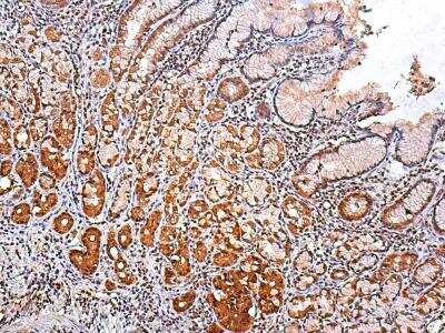 Immunohistochemistry: Slug Antibody [NBP2-27182]