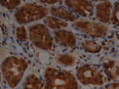Immunohistochemistry: Slug Antibody [NBP2-27182]
