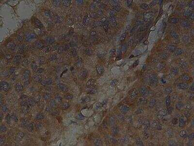Immunohistochemistry: Slug Antibody [NBP2-27182]