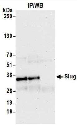 Immunoprecipitation: Slug Antibody (BLR139H) [NBP3-14719]