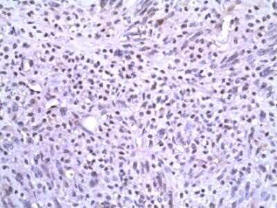 Immunohistochemistry: Slug Antibody (OTI1A6) - Azide and BSA Free [NBP2-74229]