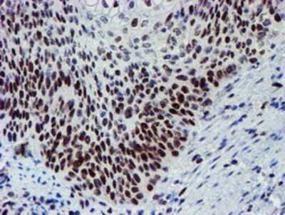 Immunohistochemistry: Slug Antibody (OTI1A6) - Azide and BSA Free [NBP2-74229]