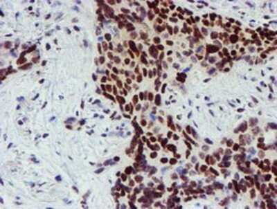 Immunohistochemistry: Slug Antibody (OTI1A6) - Azide and BSA Free [NBP2-74229]