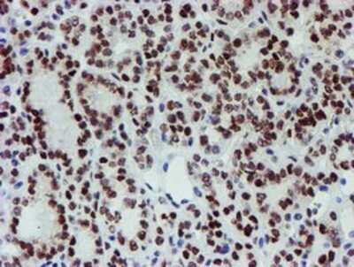 Immunohistochemistry: Slug Antibody (OTI1A6) - Azide and BSA Free [NBP2-74229]