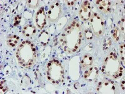 Immunohistochemistry: Slug Antibody (OTI1A6) - Azide and BSA Free [NBP2-74229]