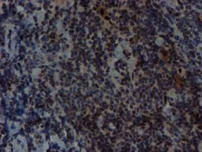 Immunohistochemistry: Slug Antibody (OTI1A6) - Azide and BSA Free [NBP2-74229]