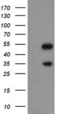 Western Blot: Slug Antibody (OTI1A6)Azide and BSA Free [NBP2-74229]