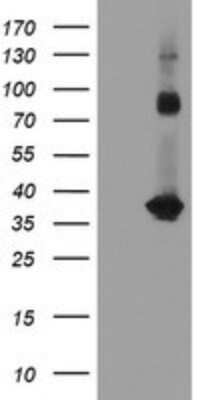 Western Blot: Slug Antibody (OTI2B11)Azide and BSA Free [NBP2-74235]