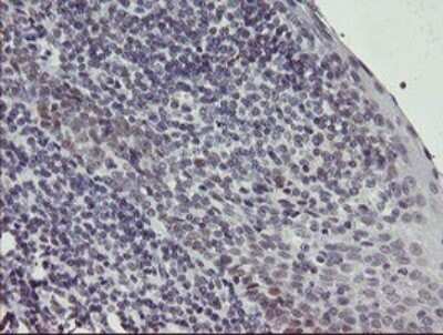 Immunohistochemistry: Slug Antibody (OTI2B11) [NBP2-45980]
