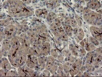Immunohistochemistry: Slug Antibody (OTI2B11) [NBP2-45980]
