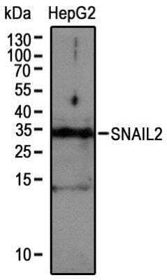 Western Blot: Slug Antibody [NBP2-27182]