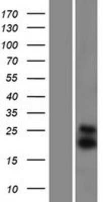 Western Blot: SMAC/Diablo Overexpression Lysate [NBP2-11272]