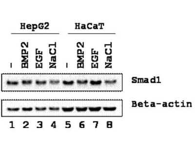 Western Blot: Smad1 [p Ser206] Antibody [NBP1-77860]