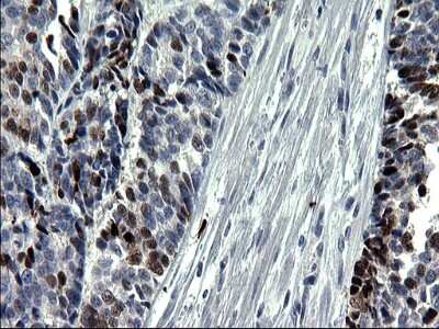 Immunohistochemistry: Smad1 Antibody (OTI1C5) [NBP2-45869]