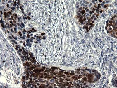 Immunohistochemistry: Smad1 Antibody (OTI1C5) [NBP2-45869]