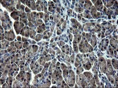 Immunohistochemistry: Smad1 Antibody (OTI1C5) [NBP2-45869]