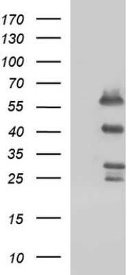 Western Blot: Smad1 Antibody (OTI1C5) [NBP2-45869]