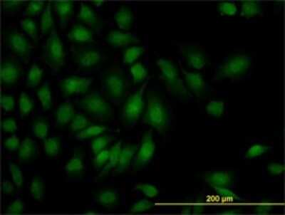 Immunocytochemistry/ Immunofluorescence: Smad1 Antibody (1D3) [H00004086-M02]