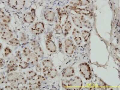 Immunohistochemistry-Paraffin: Smad1 Antibody (1D3) [H00004086-M02]