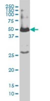 Western Blot: Smad1 Antibody (1D3) [H00004086-M02]