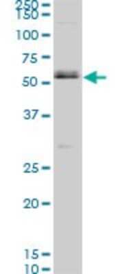 Western Blot: Smad1 Antibody (1D3) [H00004086-M02]