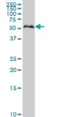Western Blot: Smad1 Antibody (2E9) [H00004086-M03]