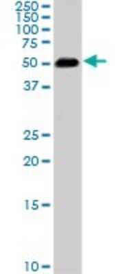 Western Blot: Smad1 Antibody (2E9) [H00004086-M03]