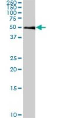 Western Blot: Smad1 Antibody (2E9) [H00004086-M03]