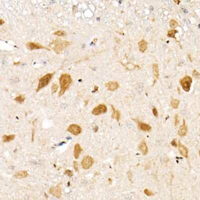 Immunohistochemistry-Paraffin: Smad1 Antibody (7H7L5) [NBP3-15670]