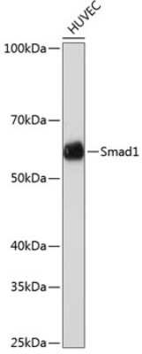 Western Blot: Smad1 Antibody (7H7L5) [NBP3-15670]