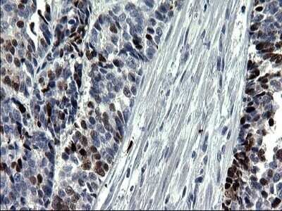 Immunohistochemistry: Smad1 Antibody (OTI1C5) - Azide and BSA Free [NBP2-74236]