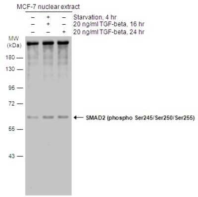 Western Blot: Smad2 [p Ser255, p Ser245, p Ser250] Antibody [NBP3-13246]