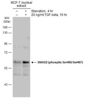 Western Blot: Smad2 [p Ser465, p Ser467] Antibody [NBP3-13273]