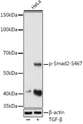 Western Blot: Smad2 [p Ser467] AntibodyAzide and BSA Free [NBP3-16891]