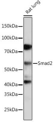 Western Blot: Smad2 Antibody (2E3D8) [NBP3-15671]