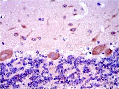 Immunohistochemistry: Smad2 Antibody (5G7) - BSA Free [NBP2-37580]