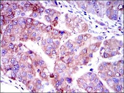 Immunohistochemistry: Smad2 Antibody (5G7) - BSA Free [NBP2-37580]