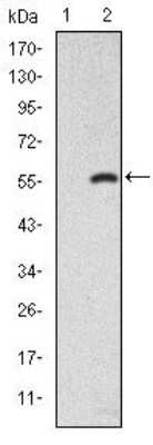 Western Blot: Smad2 Antibody (5G7)BSA Free [NBP2-37580]