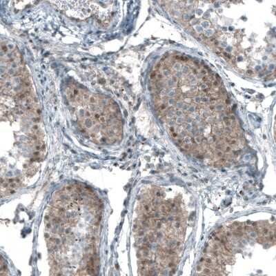 Immunohistochemistry-Paraffin: Smad2 Antibody (CL8472) [NBP2-88916]
