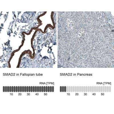 Immunohistochemistry-Paraffin: Smad2 Antibody (CL8472) [NBP2-88916]