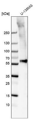 Western Blot: Smad2 Antibody (CL8472) [NBP2-88916]