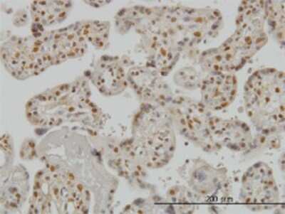 Immunohistochemistry-Paraffin: Smad3 Antibody (7F3) [H00004088-M02]
