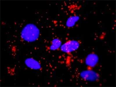 Proximity Ligation Assay: Smad3 Antibody (7F3) [H00004088-M02]