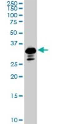 Western Blot: Smad3 Antibody (7F3) [H00004088-M02]