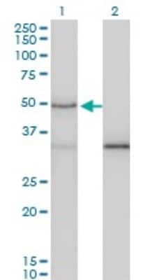 Western Blot: Smad3 Antibody (7F3) [H00004088-M02]