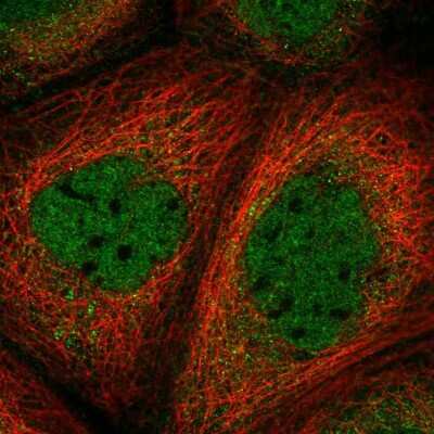 Immunocytochemistry/ Immunofluorescence: Smad3 Antibody [NBP2-55307]